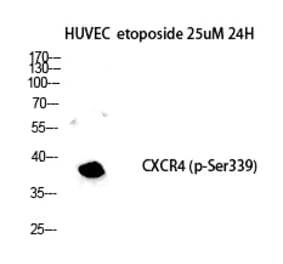 Western blot - Fusin (Phospho-Ser339) Polyclonal Antibody from Signalway Antibody (12362) - Antibodies.com