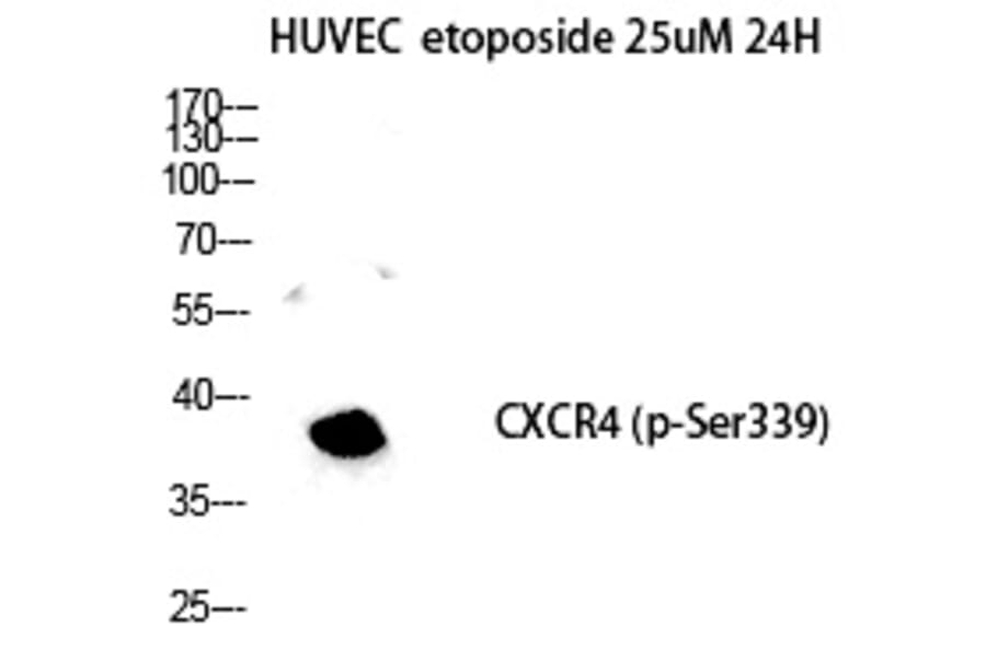 Western blot - Fusin (Phospho-Ser339) Polyclonal Antibody from Signalway Antibody (12362) - Antibodies.com