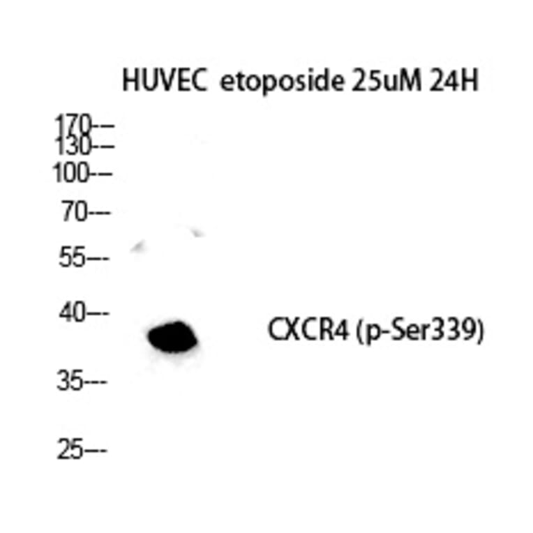Western blot - Fusin (Phospho-Ser339) Polyclonal Antibody from Signalway Antibody (12362) - Antibodies.com