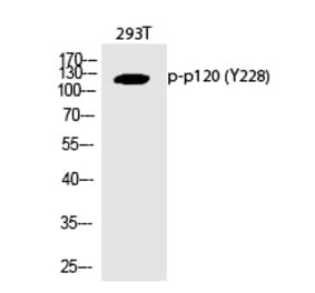Western blot - p120 (Phospho-Tyr228) Polyclonal Antibody from Signalway Antibody (12363) - Antibodies.com