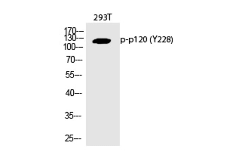 Western blot - p120 (Phospho-Tyr228) Polyclonal Antibody from Signalway Antibody (12363) - Antibodies.com