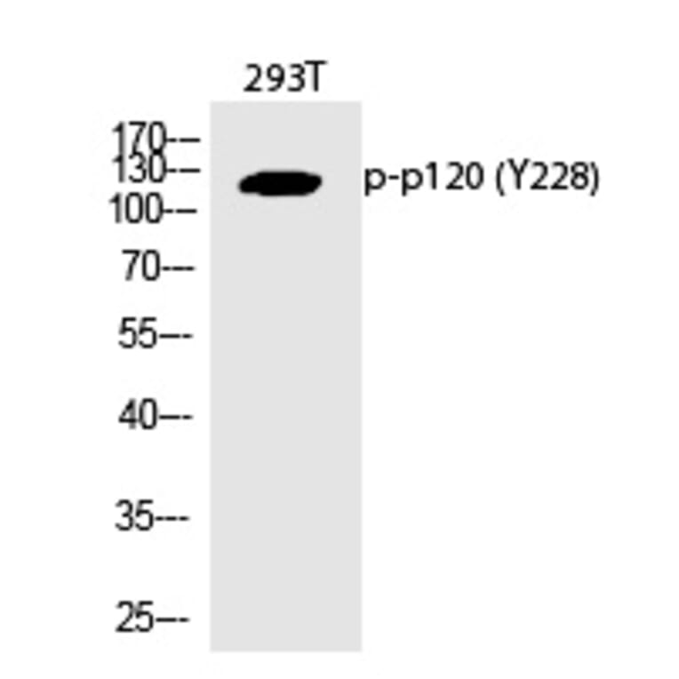 Western blot - p120 (Phospho-Tyr228) Polyclonal Antibody from Signalway Antibody (12363) - Antibodies.com