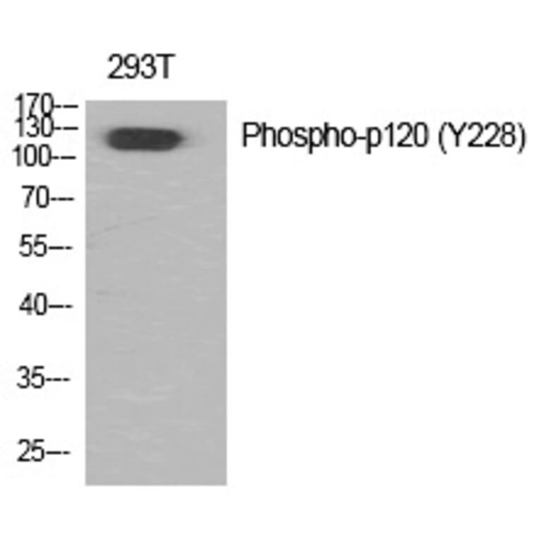 Western blot - p120 (Phospho-Tyr228) Polyclonal Antibody from Signalway Antibody (12363) - Antibodies.com