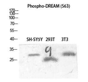 Western blot - DREAM (Phospho-Ser63) Polyclonal Antibody from Signalway Antibody (12366) - Antibodies.com