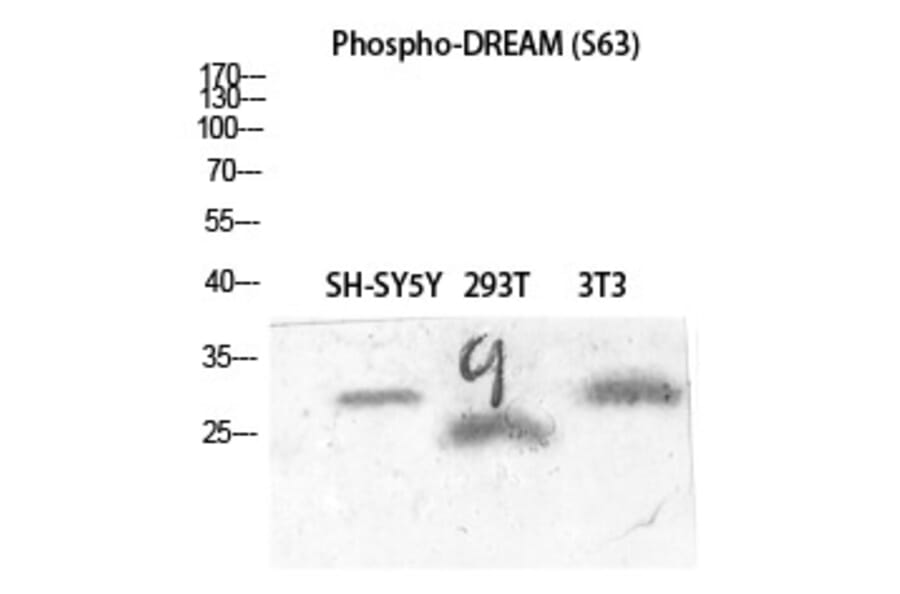 Western blot - DREAM (Phospho-Ser63) Polyclonal Antibody from Signalway Antibody (12366) - Antibodies.com