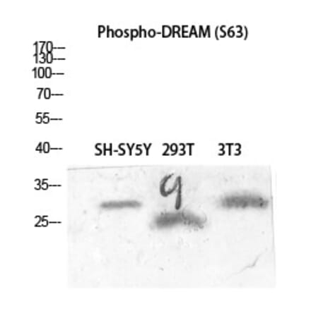 Western blot - DREAM (Phospho-Ser63) Polyclonal Antibody from Signalway Antibody (12366) - Antibodies.com