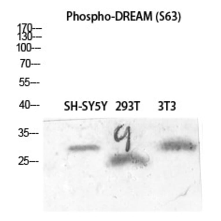 Western blot - DREAM (Phospho-Ser63) Polyclonal Antibody from Signalway Antibody (12366) - Antibodies.com