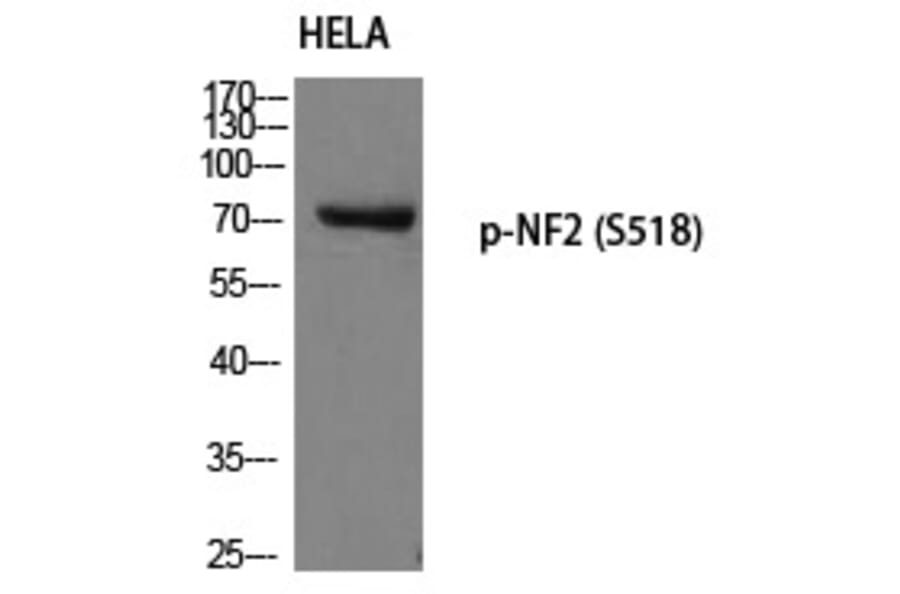 Western blot - NF2 (Phospho-Ser518) Polyclonal Antibody from Signalway Antibody (12211) - Antibodies.com