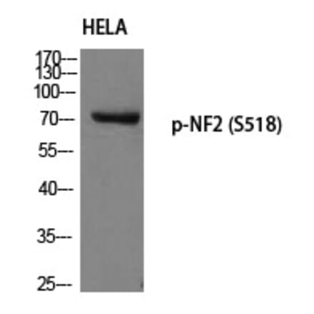 Western blot - NF2 (Phospho-Ser518) Polyclonal Antibody from Signalway Antibody (12211) - Antibodies.com