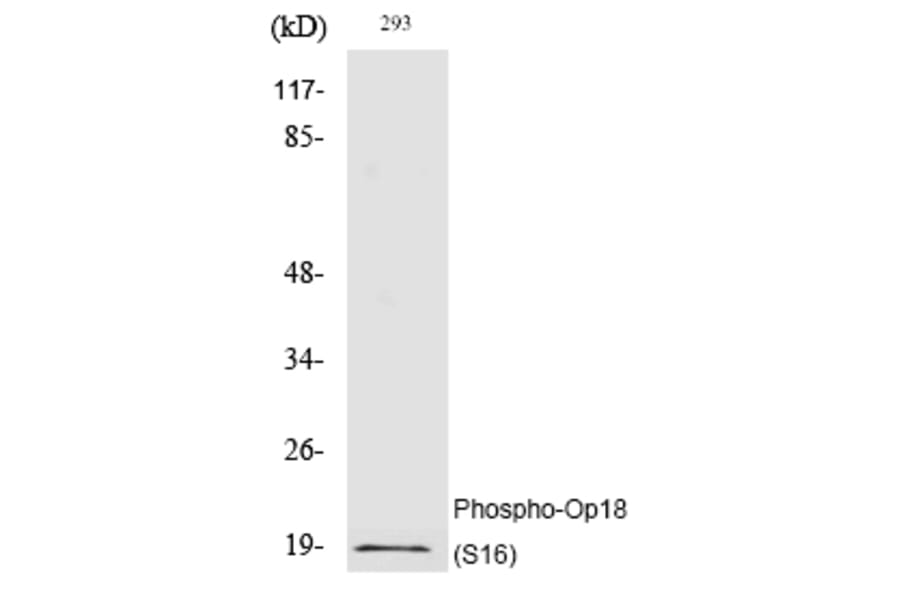Western blot - Op18 (Phospho-Ser16) Polyclonal Antibody from Signalway Antibody (12212) - Antibodies.com