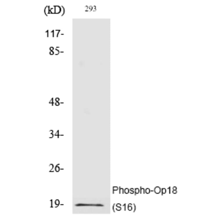 Western blot - Op18 (Phospho-Ser16) Polyclonal Antibody from Signalway Antibody (12212) - Antibodies.com