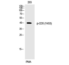 Western blot - CD5 (Phospho-Tyr453) Polyclonal Antibody from Signalway Antibody (12269) - Antibodies.com
