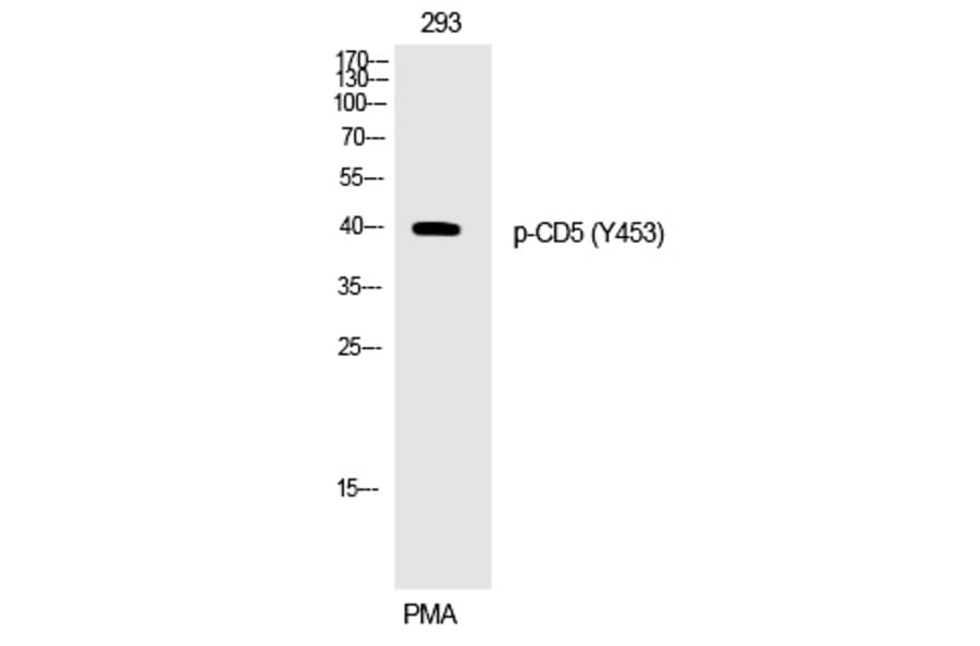 Western blot - CD5 (Phospho-Tyr453) Polyclonal Antibody from Signalway Antibody (12269) - Antibodies.com