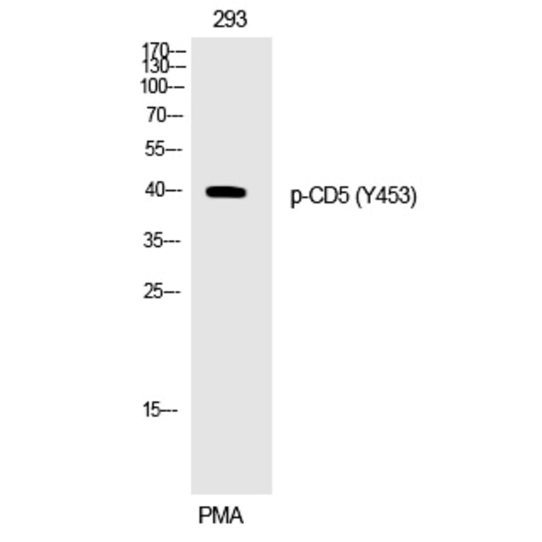Western blot - CD5 (Phospho-Tyr453) Polyclonal Antibody from Signalway Antibody (12269) - Antibodies.com