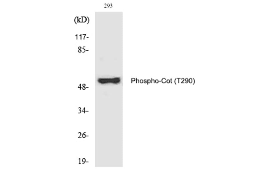 Western blot - Cot (Phospho-Thr290) Polyclonal Antibody from Signalway Antibody (12348) - Antibodies.com
