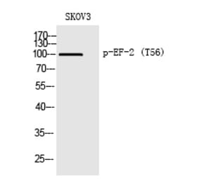 Western blot - EF-2 (Phospho-Thr56) Polyclonal Antibody from Signalway Antibody (12351) - Antibodies.com