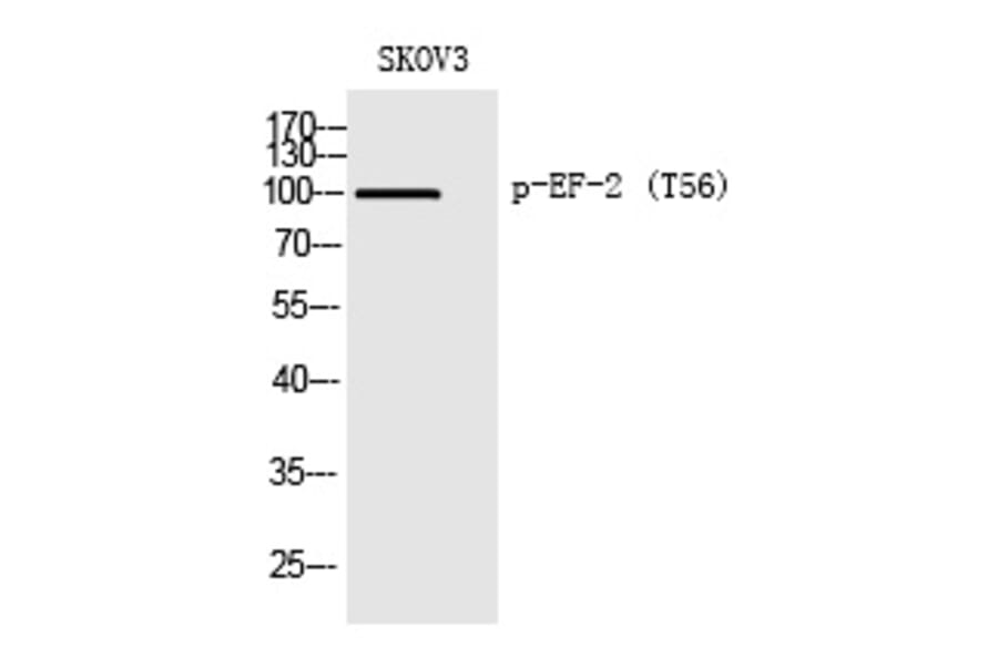 Western blot - EF-2 (Phospho-Thr56) Polyclonal Antibody from Signalway Antibody (12351) - Antibodies.com