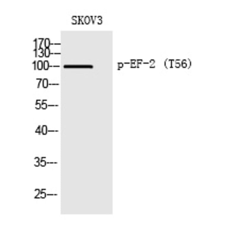 Western blot - EF-2 (Phospho-Thr56) Polyclonal Antibody from Signalway Antibody (12351) - Antibodies.com