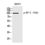 Western blot - EF-2 (Phospho-Thr56) Polyclonal Antibody from Signalway Antibody (12351) - Antibodies.com