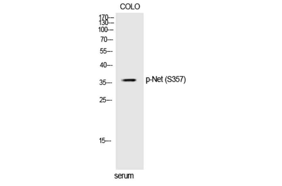 Western blot - Net (Phospho-Ser357) Polyclonal Antibody from Signalway Antibody (12364) - Antibodies.com