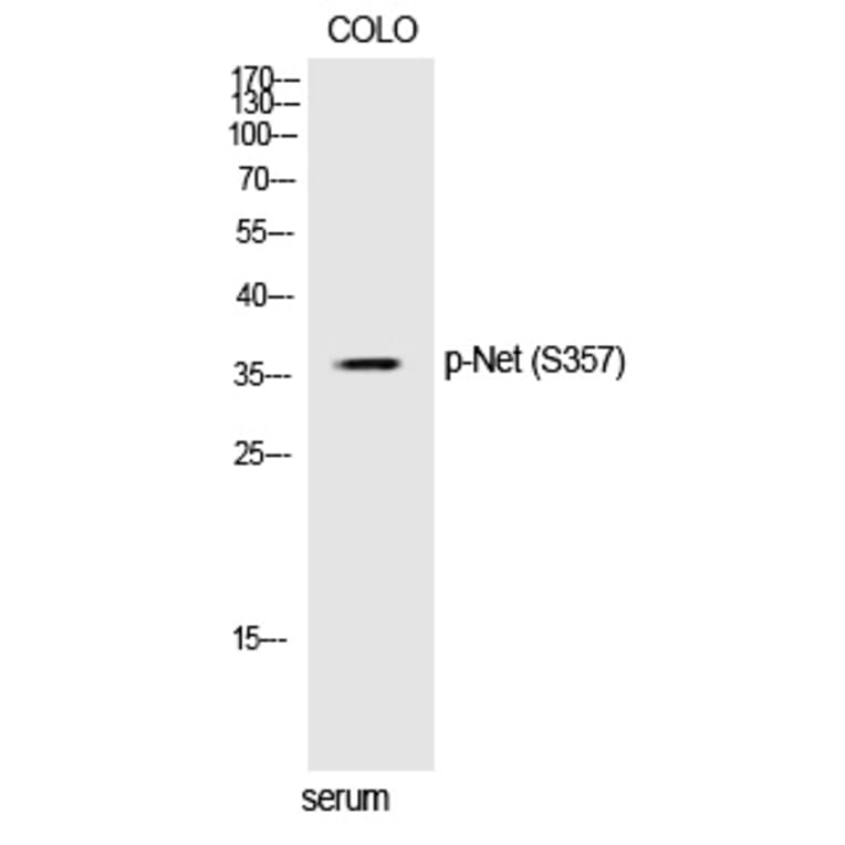 Western blot - Net (Phospho-Ser357) Polyclonal Antibody from Signalway Antibody (12364) - Antibodies.com