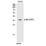 Western blot - Net (Phospho-Ser357) Polyclonal Antibody from Signalway Antibody (12364) - Antibodies.com