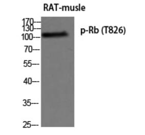 Western blot - Rb (Phospho-Thr826) Polyclonal Antibody from Signalway Antibody (12274) - Antibodies.com