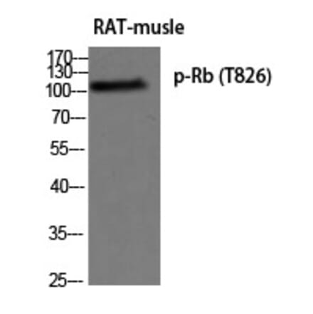 Western blot - Rb (Phospho-Thr826) Polyclonal Antibody from Signalway Antibody (12274) - Antibodies.com