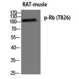 Western blot - Rb (Phospho-Thr826) Polyclonal Antibody from Signalway Antibody (12274) - Antibodies.com
