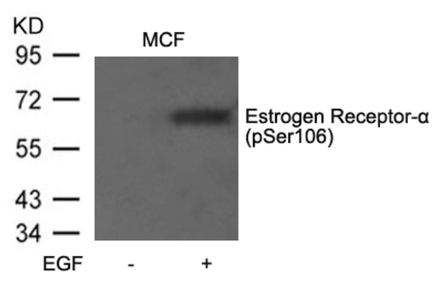 Western blot - Estrogen Receptor-a (Phospho-Ser106) Antibody from Signalway Antibody (11071) - Antibodies.com