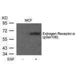 Western blot - Estrogen Receptor-a (Phospho-Ser106) Antibody from Signalway Antibody (11071) - Antibodies.com