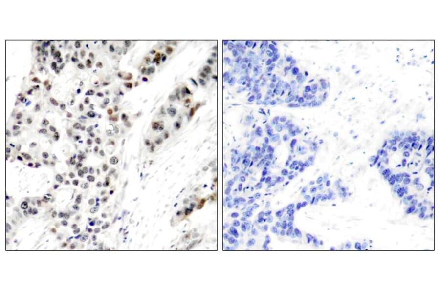 Immunohistochemistry - Estrogen Receptor-a (Phospho-Ser106) Antibody from Signalway Antibody - Antibodies.com