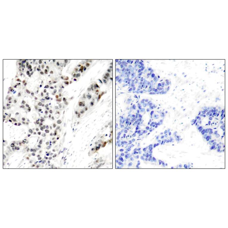 Immunohistochemistry - Estrogen Receptor-a (Phospho-Ser106) Antibody from Signalway Antibody - Antibodies.com