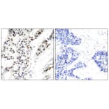 Immunohistochemistry - Estrogen Receptor-a (Phospho-Ser106) Antibody from Signalway Antibody - Antibodies.com