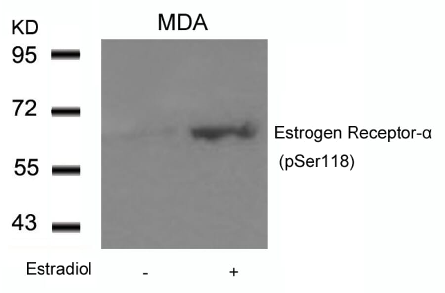 Western blot - Estrogen Receptor-a (Phospho-Ser118) Antibody from Signalway Antibody (11072) - Antibodies.com