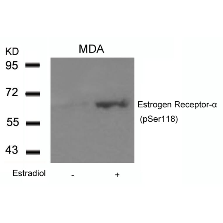 Western blot - Estrogen Receptor-a (Phospho-Ser118) Antibody from Signalway Antibody (11072) - Antibodies.com