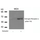 Western blot - Estrogen Receptor-a (Phospho-Ser118) Antibody from Signalway Antibody (11072) - Antibodies.com