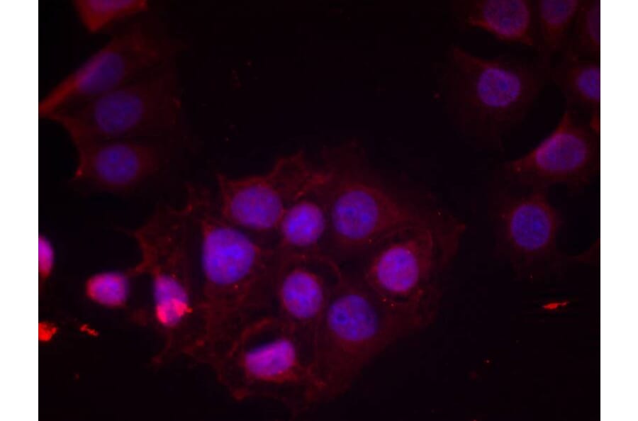 Immunofluorescence - Estrogen Receptor-a (Phospho-Ser118) Antibody from Signalway Antibody (11072) - Antibodies.com