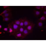 Immunofluorescence - Estrogen Receptor-a (Phospho-Ser118) Antibody from Signalway Antibody (11072) - Antibodies.com