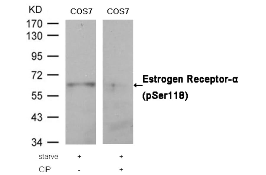 Western blot - Estrogen Receptor-a (Phospho-Ser118) Antibody from Signalway Antibody (11072) - Antibodies.com
