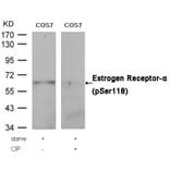 Western blot - Estrogen Receptor-a (Phospho-Ser118) Antibody from Signalway Antibody (11072) - Antibodies.com