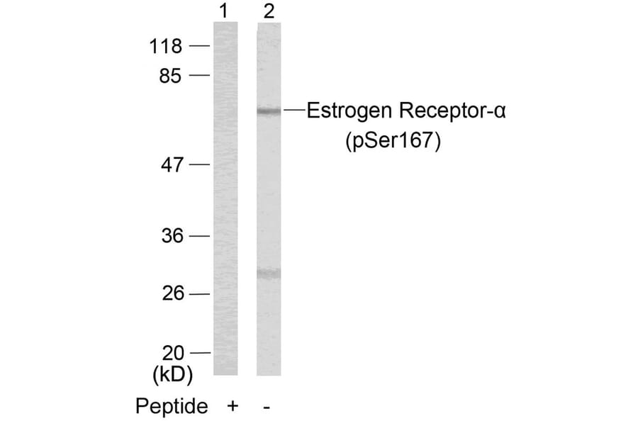 Western blot - Estrogen Receptor-a (Phospho-Ser167) Antibody from Signalway Antibody (11073) - Antibodies.com