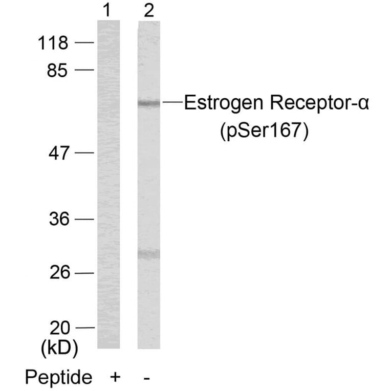 Western blot - Estrogen Receptor-a (Phospho-Ser167) Antibody from Signalway Antibody (11073) - Antibodies.com