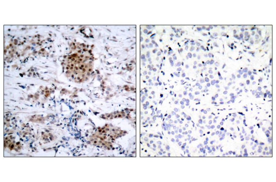 Immunohistochemistry - Estrogen Receptor-a (Phospho-Ser167) Antibody from Signalway Antibody - Antibodies.com