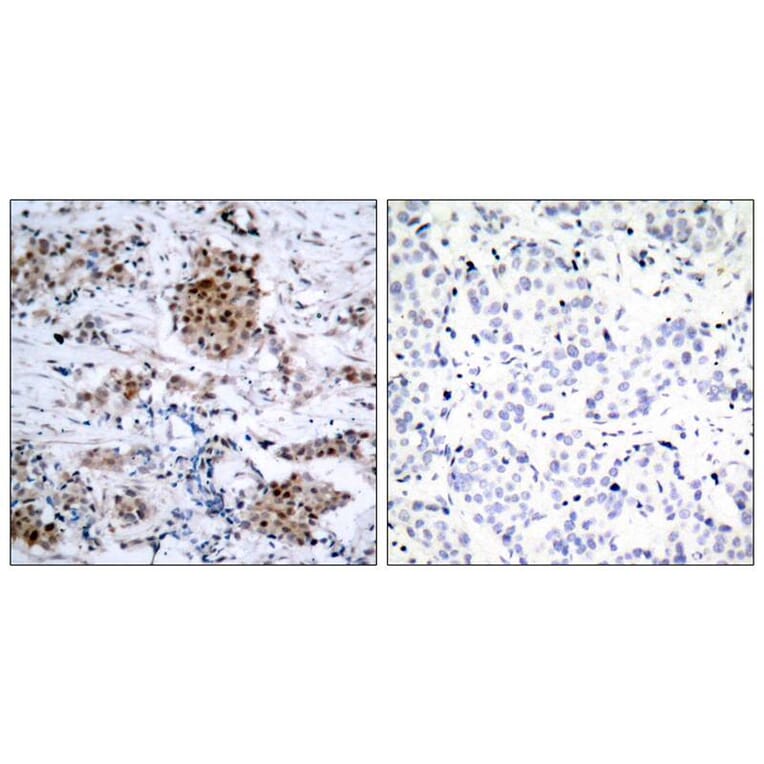 Immunohistochemistry - Estrogen Receptor-a (Phospho-Ser167) Antibody from Signalway Antibody - Antibodies.com