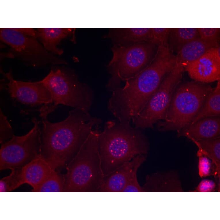 Immunofluorescence - Estrogen Receptor-a (Phospho-Ser167) Antibody from Signalway Antibody (11073) - Antibodies.com