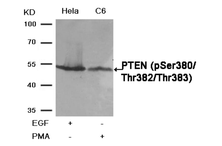 Western blot - PTEN (Phospho-Ser380/Thr382/Thr383) Antibody from Signalway Antibody (11056) - Antibodies.com