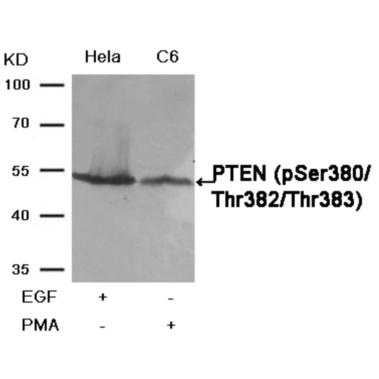 Western blot - PTEN (Phospho-Ser380/Thr382/Thr383) Antibody from Signalway Antibody (11056) - Antibodies.com