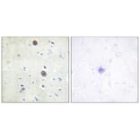 Immunohistochemistry - Amyloid β A4 (Phospho-Thr743/668) Antibody from Signalway Antibody - Antibodies.com