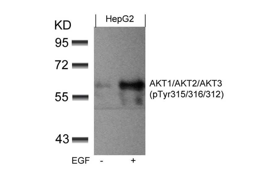 Western blot - AKT1/AKT2/AKT3 (phospho-Tyr315/316/312) Antibody from Signalway Antibody (11501) - Antibodies.com